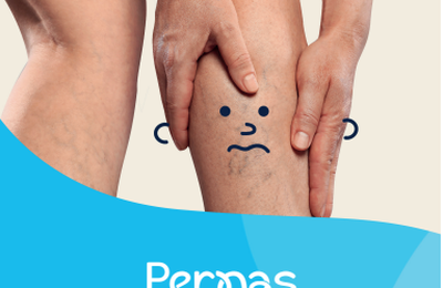 “Escute Suas Pernas”: campanha faz alerta sobre saúde vascular