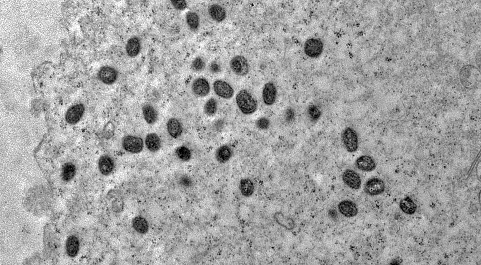 monkeypox_02