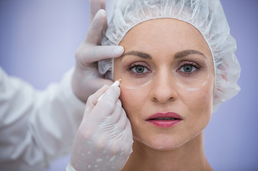 Saiba por que a blefaroplastia é a cirurgia estética mais realizada no mundo