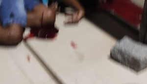 Homem é morto com tiros na cabeça e duas pessoas ficam feridas em Aracaju