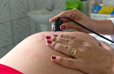 Exame pré-natal reduz chance de bebê nascer com anomalia
