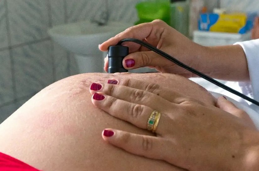 OMS: 300 mil mulheres morrem anualmente em razão de gravidez ou parto