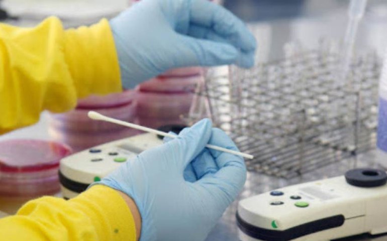 Saúde admite que quantidade de testes para coronavírus feita no País não é ideal