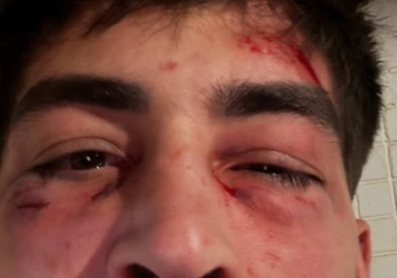 'Foi quase um linchamento', diz empresário agredido por seguranças de karaokê no centro de SP