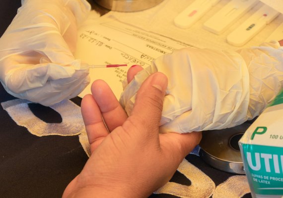 Saúde abre inscrições para oficina sobre aconselhamento, prevenção combinada e teste rápido