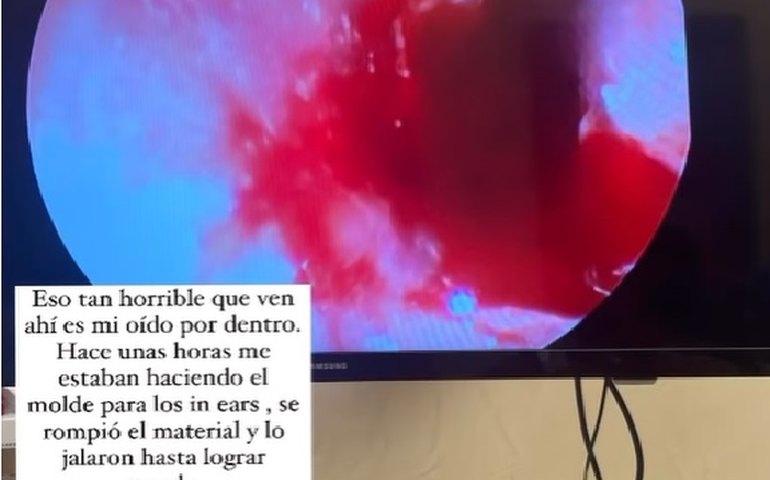 Anahí sofre perfuração no tímpano cinco meses antes da turnê 'Soy Rebelde'