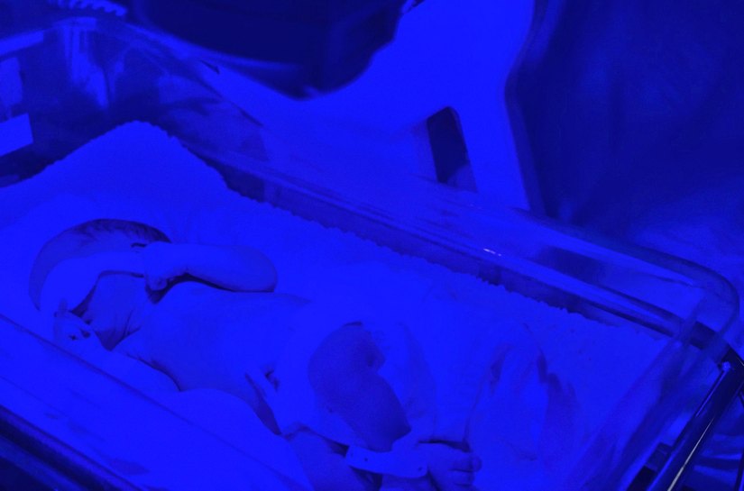 Pediatra reforça importância da fototerapia para tratamento de icterícia em recém-nascidos