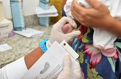Cria reforça importância do teste do pezinho durante a pandemia