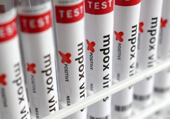 Saiba quais os 8 países que registram casos da nova variante de Mpox