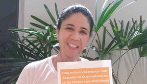 QUEIMADURA / Foto: Assessoria CHANGE.ORG Brasil