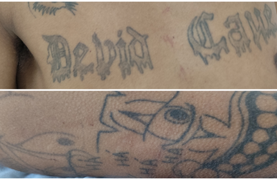 Hospital de Emergência do Agreste procura familiares de paciente identificado apenas como Rafael