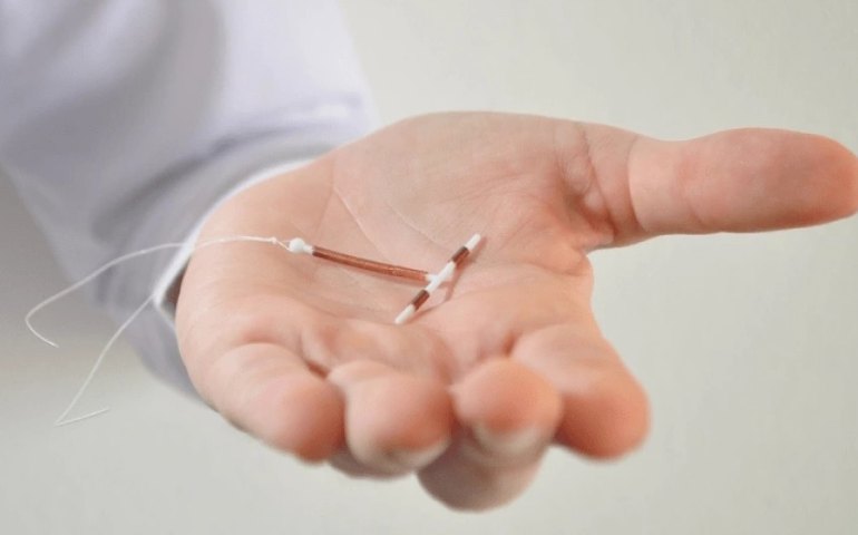 DIU: saiba mais informações sobre o método contraceptivo