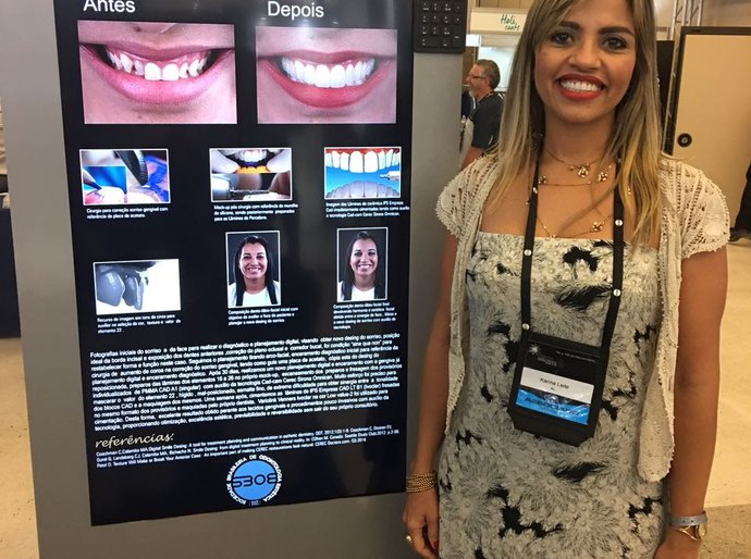 Odontologia Estética: Caso alagoano é um dos melhores do país em 2016