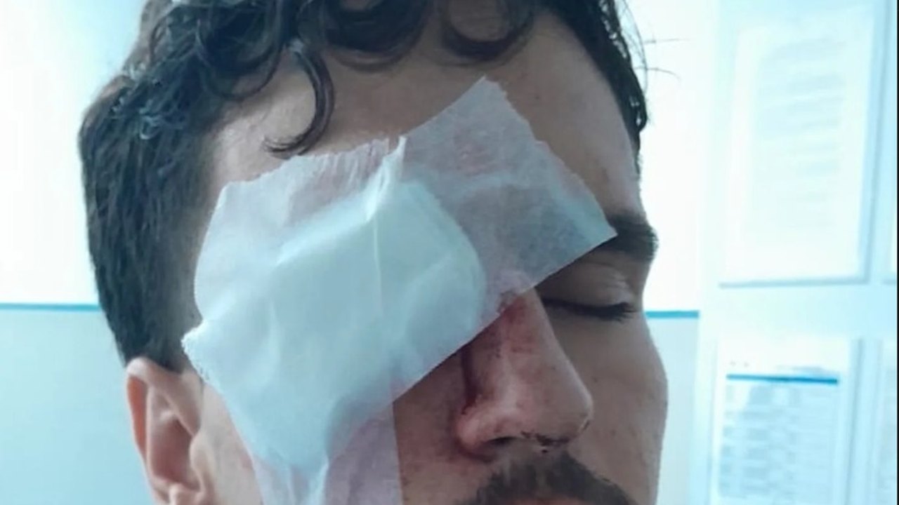 Torcedor do Vasco perde visão após ser atingido por bala de borracha em ação policial