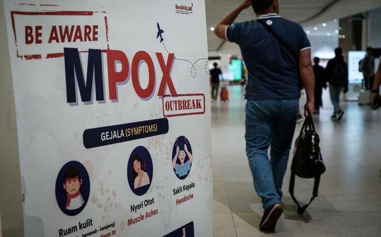 Mpox: gotículas respiratórias são via 'menor' de transmissão, segundo a OMS