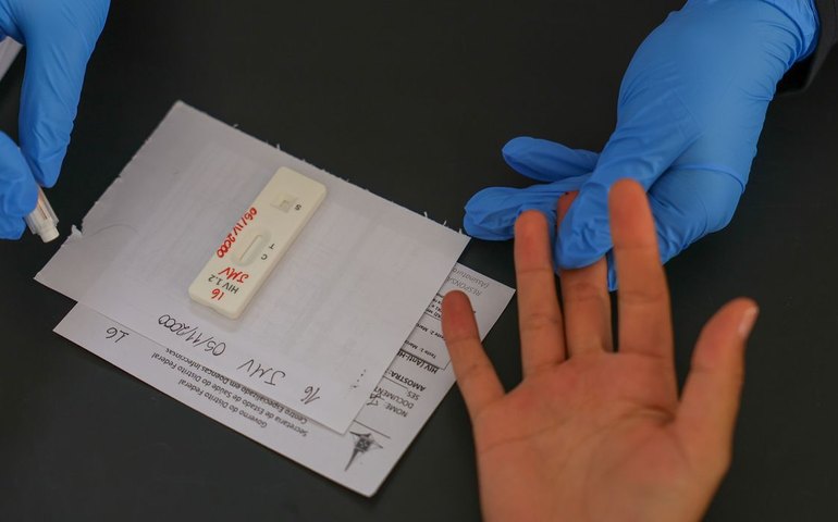 HIV/Aids: Brasil vai insistir em acordo por PrEP de longa duração