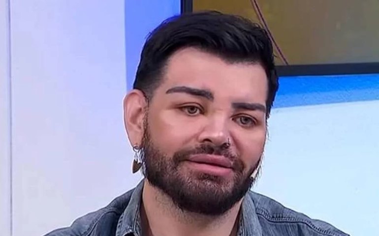 Ator argentino faz mais de 30 cirurgias para se parecer com Ricky Martin e quase perde a visão