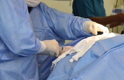 Pacientes cardíacos do SUS são incluídos em parceria da Sesau e Hospital do Coração