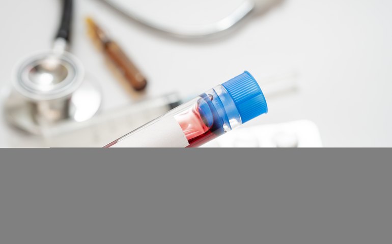 China não apresenta novas mortes por covid-19 pelo 10º dia consecutivo