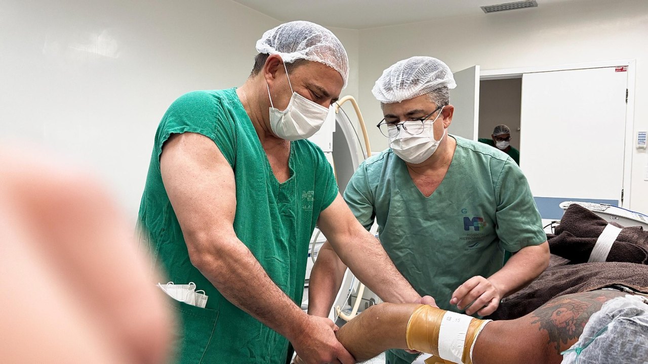 Hospital Metropolitano realiza cirurgia ortopédica de alta complexidade em caso raro de fratura não consolidada