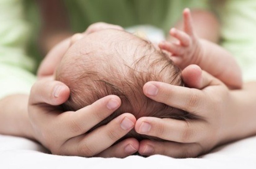 No HGE, bebês com suspeita de microcefalia realizam tomografia computadorizada