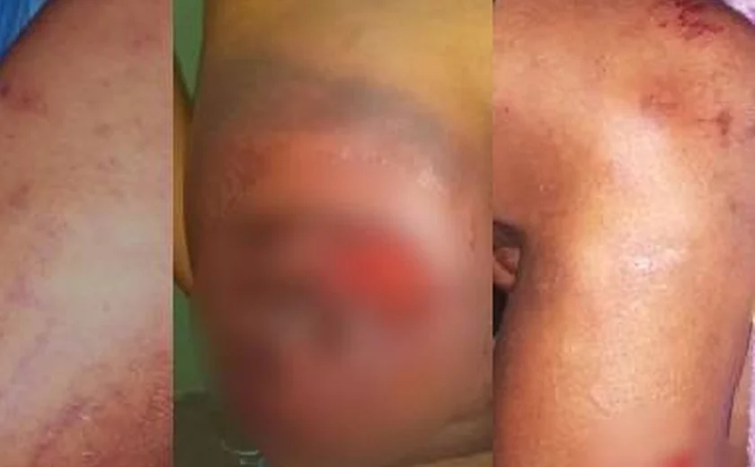 Guarda Municipal é acusada de agressão em São José da Laje