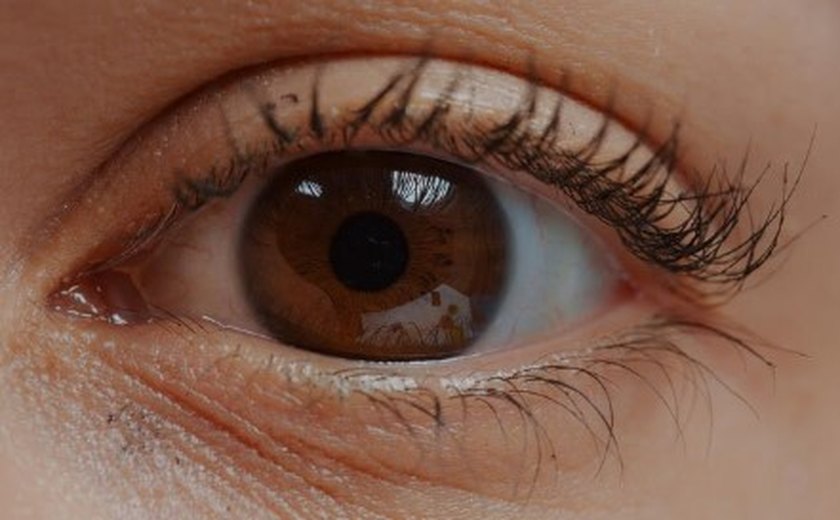 Urgência oftalmológica: fique atento aos sinais do descolamento de retina