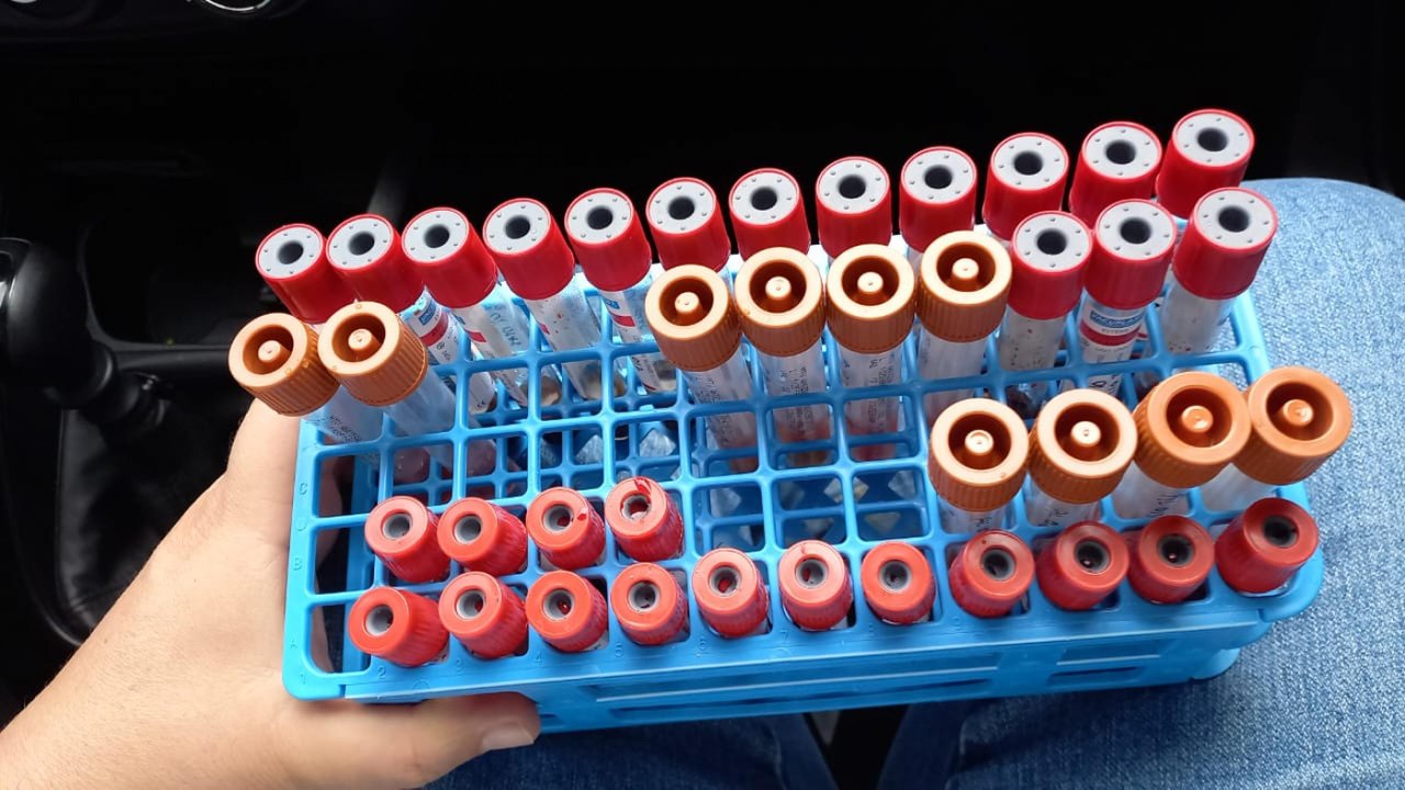 Adeal inicia coleta de amostras para identificar influenza aviária e doença de Newcastle