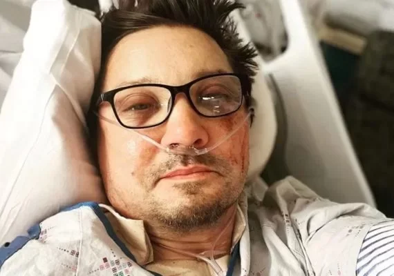 Jeremy Renner faz primeira aparição após acidente: “Esculhambado”