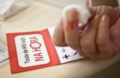 Especialistas defendem prevenção à aids com métodos combinados