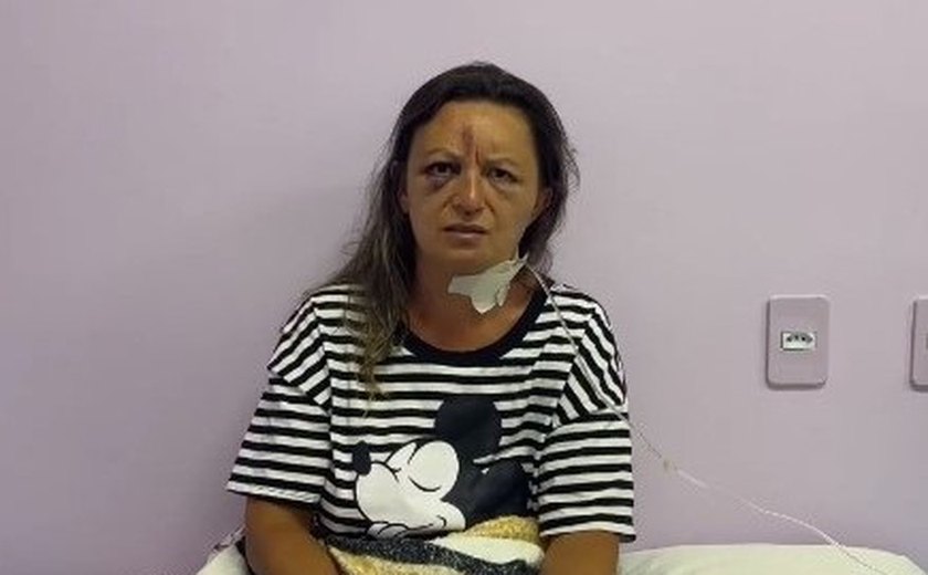 Mulher estuprada e criança espancada em Palmeira recebem alta do HEA