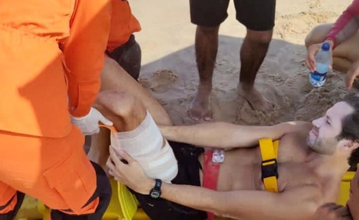 Deputado se machuca ao praticar surf em Maceió