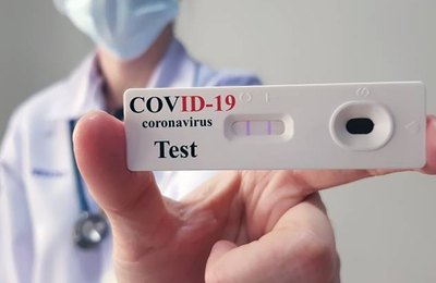 Saúde intensificará testagem rápida em profissionais da linha direta do combate à Covid-19 em Arapiraca