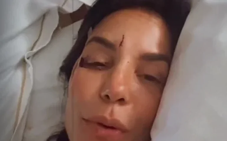 Ivete Sangalo relata susto de saúde e tranquiliza fãs: “Desmaiei, mas estou bem”