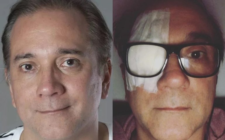 Vocalista do Biquíni Cavadão faz cirurgia para retirar tumor maligno