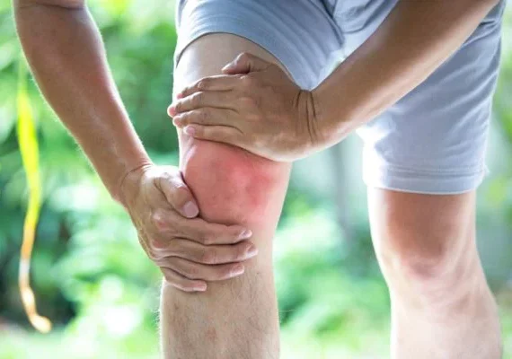 Artrose severa: conheça 4 sinais que indicam necessidade de cirurgia