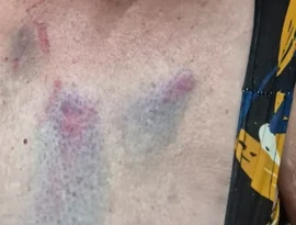 Médica é presa por agredir tia idosa de 77 anos  em Arapiraca