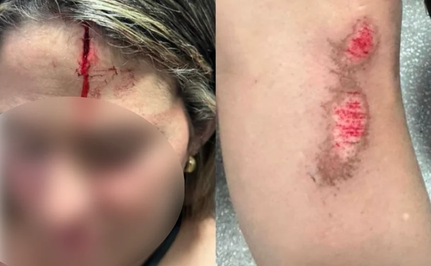 Mulher é atropelada e agredida pelo ex-companheiro no Sertão