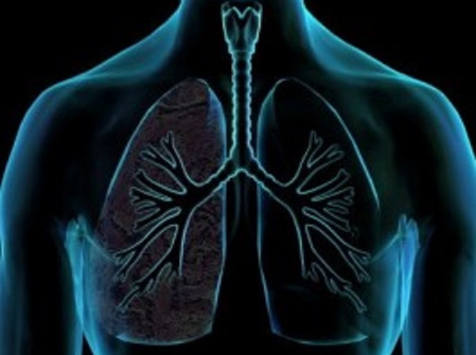 Reunião científica na Santa Casa discute Doença Pulmonar Intersticial