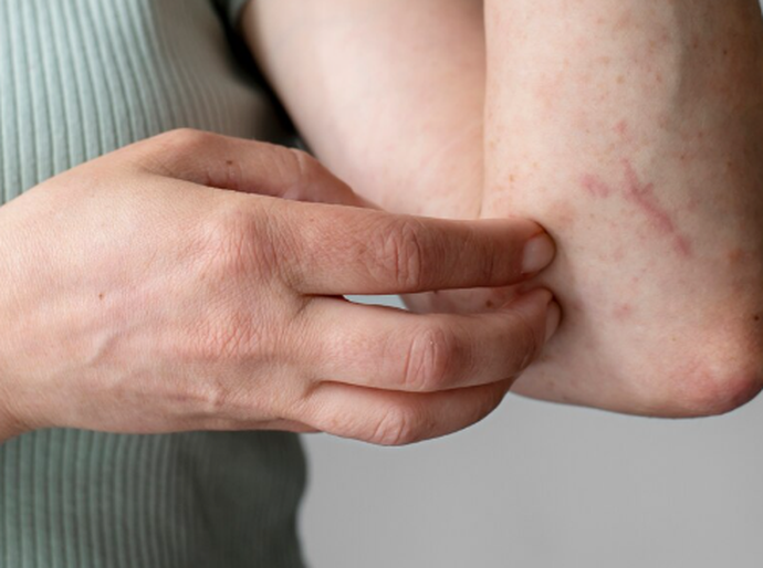 Veterinário alerta para os cuidados com a esporotricose, infecção fúngica comum em gatos, que tem crescido entre os tutores