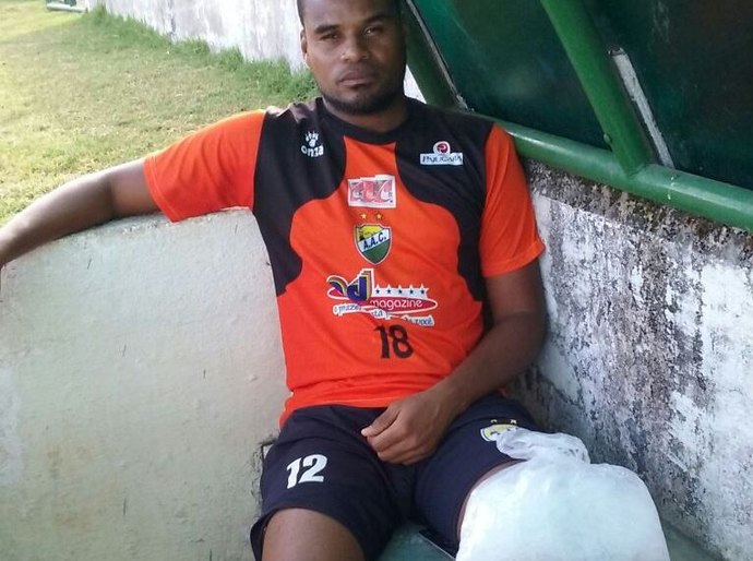 Coruripe: cirurgia no joelho direito tira goleiro Dida dos primeiros jogos do estadual