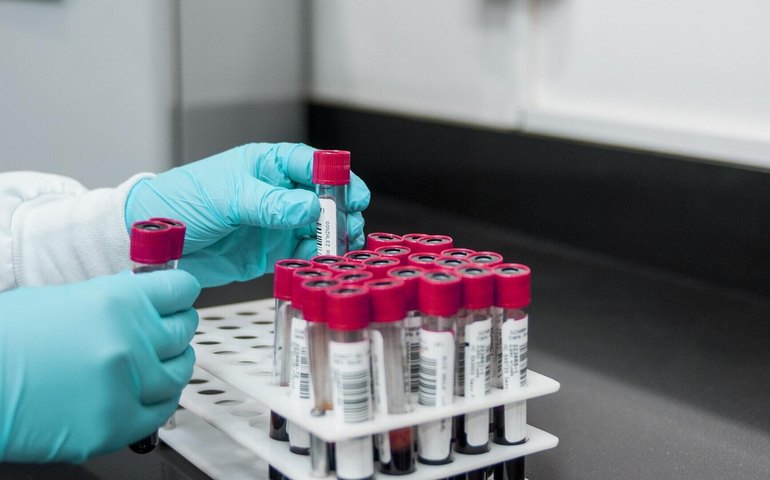 Mídia: cientista brasileiro tem mais de 30 estudos cancelados por suspeita de fraudes