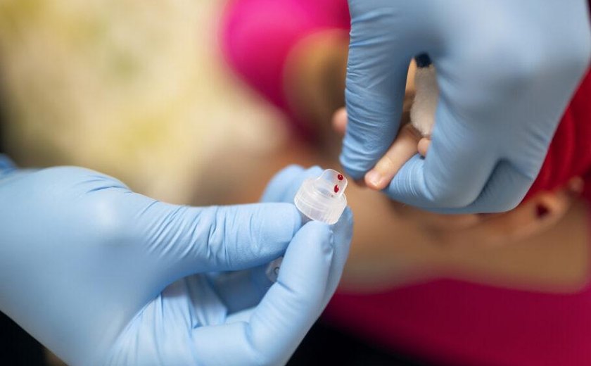 Hepatite infantil misteriosa: governo monitora casos suspeitos em SP e mais 5 Estados