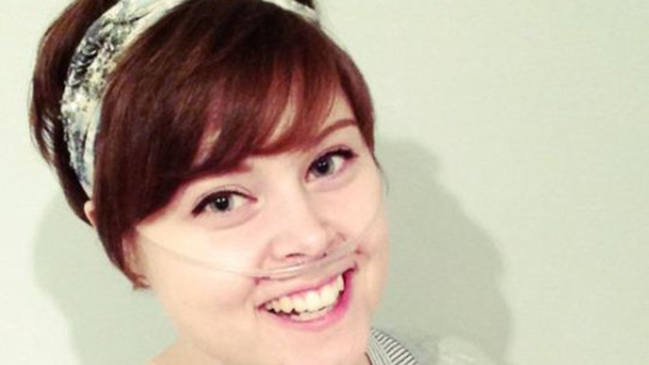 O corpo desta jovem de 23 anos está virando pedra