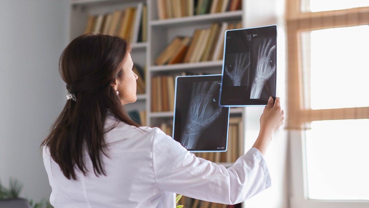 Menos exames de imagem, recomendam especialistas em dor