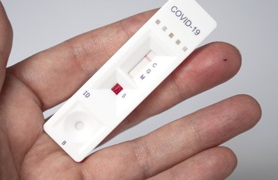 Centro de Triagem Covid-19 de Coruripe será desativado devido à baixa demanda