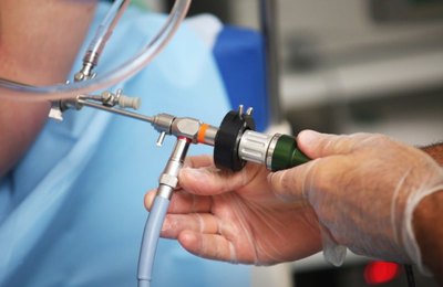 Saúde amplia oferta de histeroscopia diagnóstica para usuárias do SUS