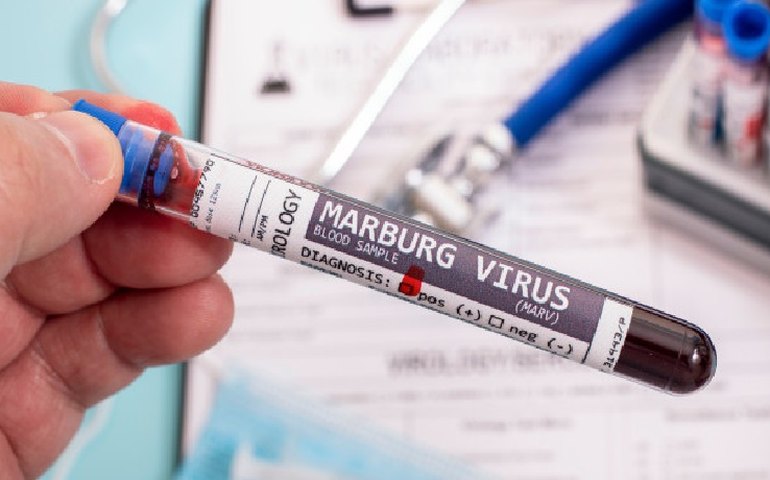 Guiné Equatorial tem surto do vírus de Marburg