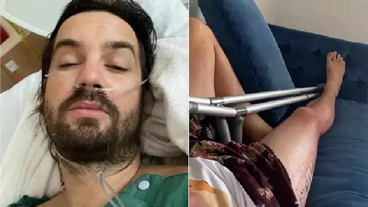 Vocalista da banda Tame Impala, Kevin Parker fratura o quadril