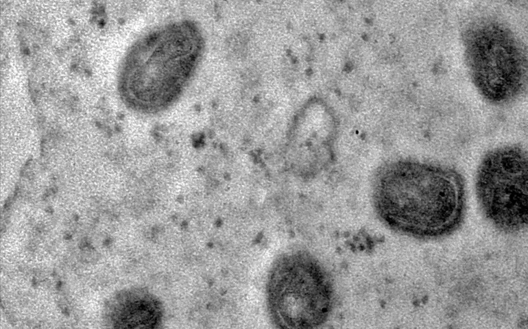 Mpox: o que é emergência internacional decretada pela OMS?